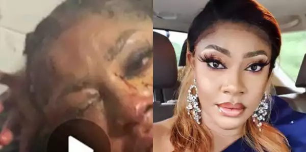 Photos of actress Angela Okorie covered in blood after gunmen riddled her car with bullets